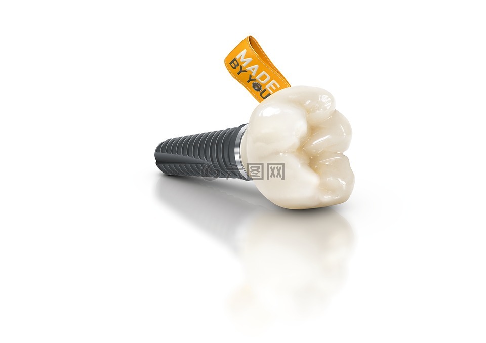 cerec,指南,由u