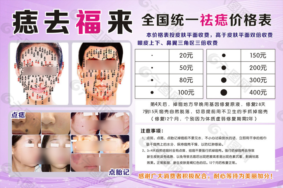 祛痣價格表
