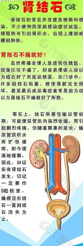 肾结石x展架图片