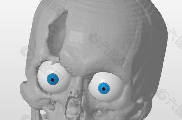 CSI风格头骨创建从CT扫描图像