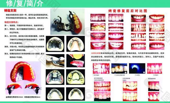 牙科 展板图片