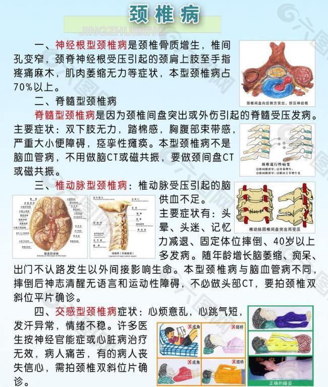 颈椎病展板图片
