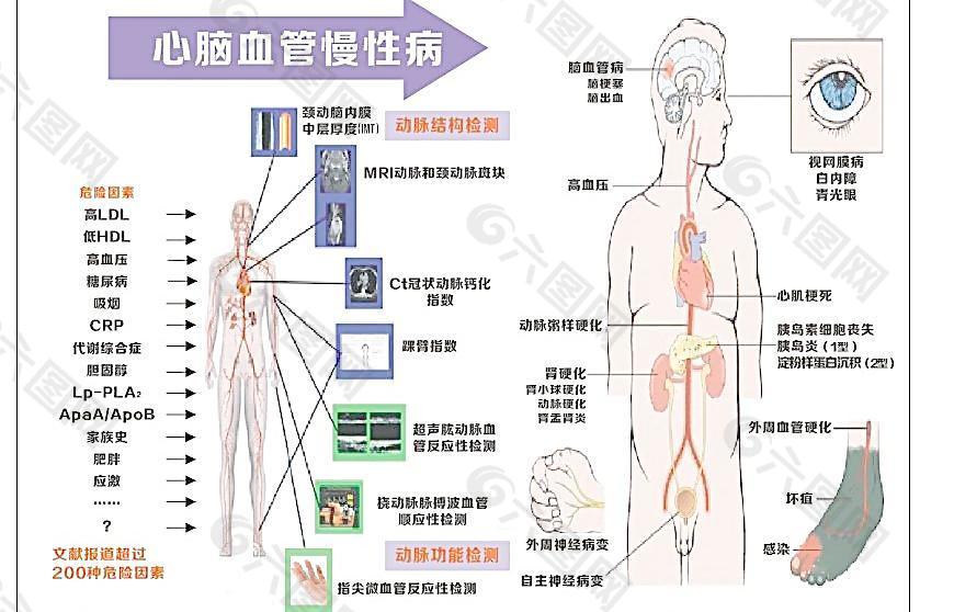 心脑血管慢性病图片