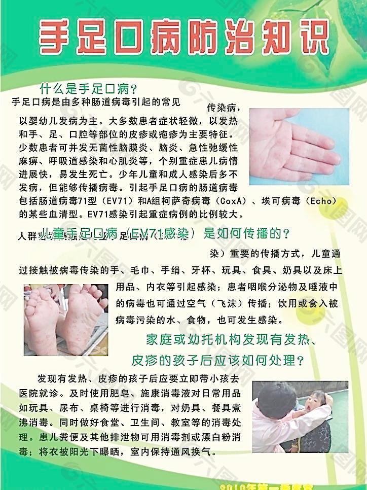 手足口病最佳治疗方法图片
