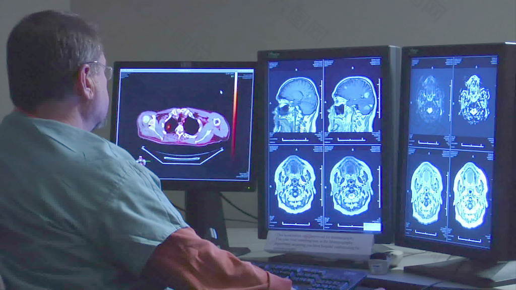 放射科医生看监控录像脑扫描的股票 视频免费下载