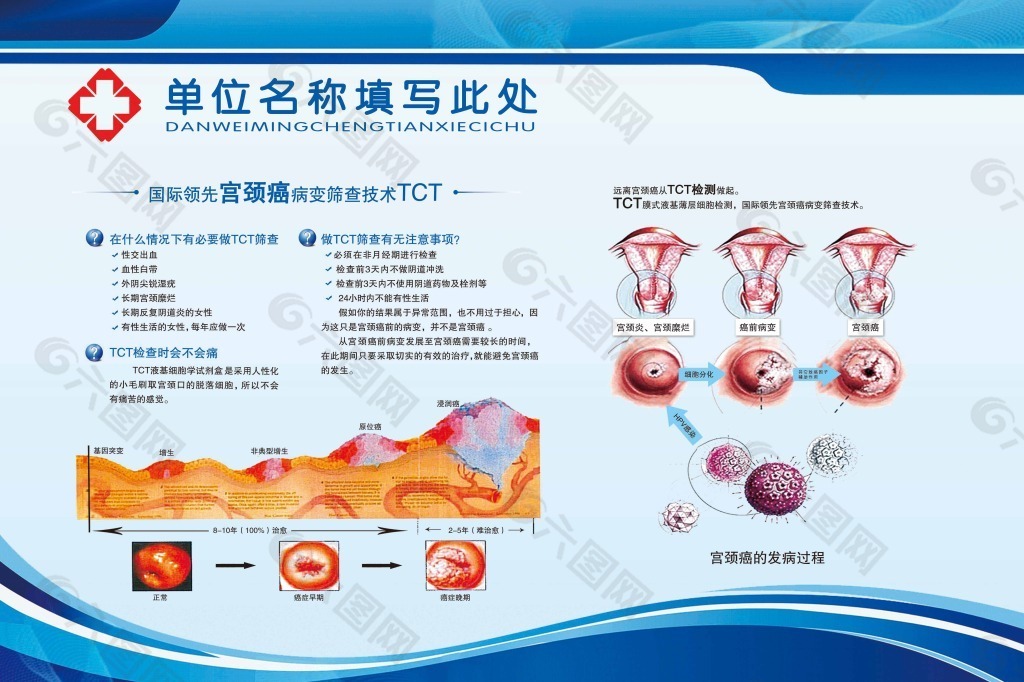 医院展板之TCT宫颈癌筛查