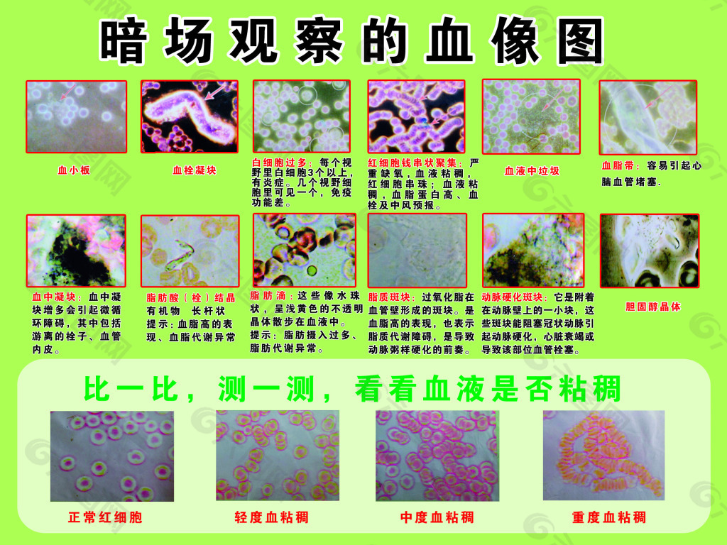 暗场观察的血像图