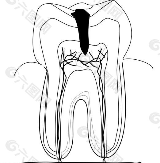 假牙 牙齿 医用模型 矢量素材 EPS_0051