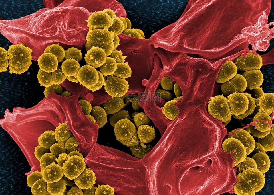 细菌,电子显微镜,染色