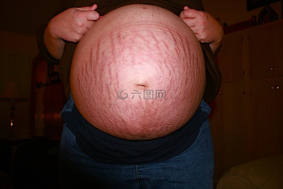 怀孕,妊娠纹,肚子