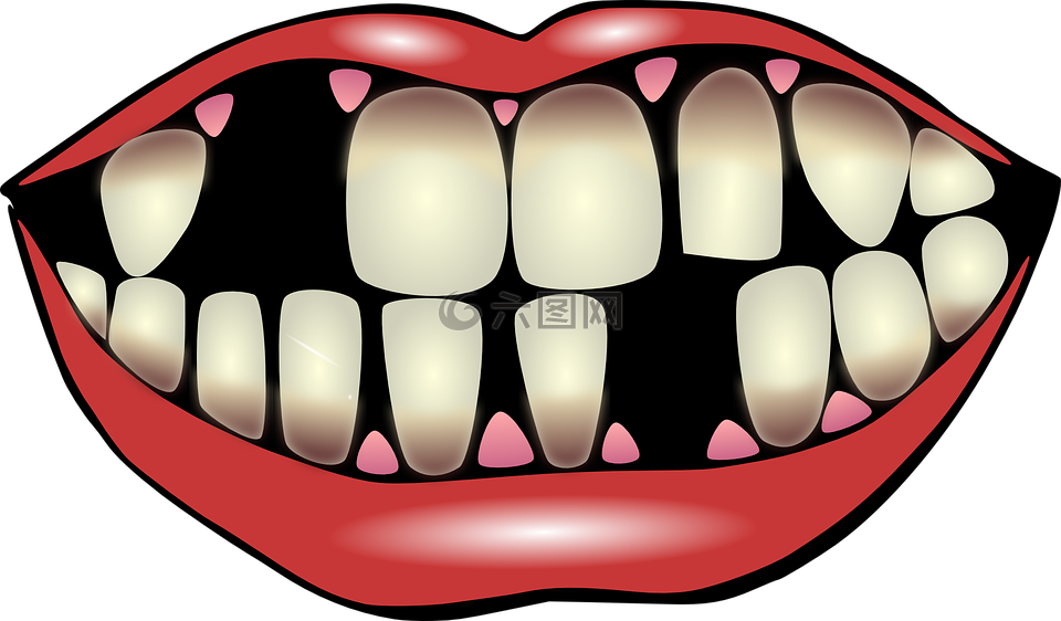 牙齿卫生,牙科护理服务,掉下来的牙齿