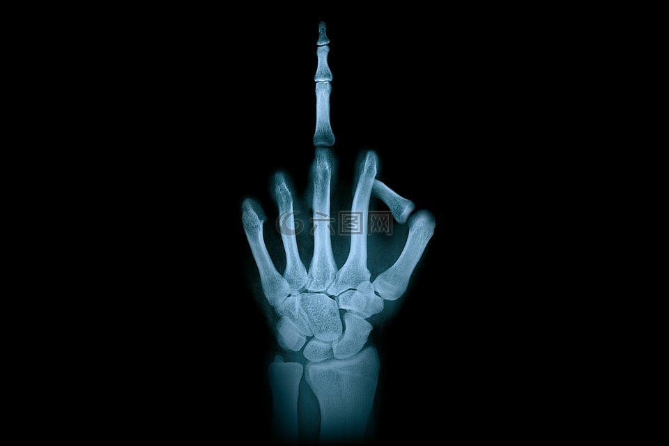 手,中指,x射线辐射