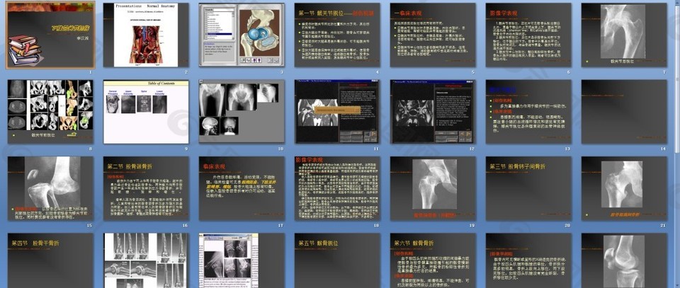下肢骨关节损伤PPT课件