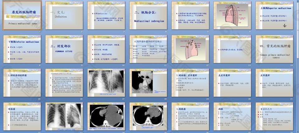 原发性纵隔肿瘤(课件)