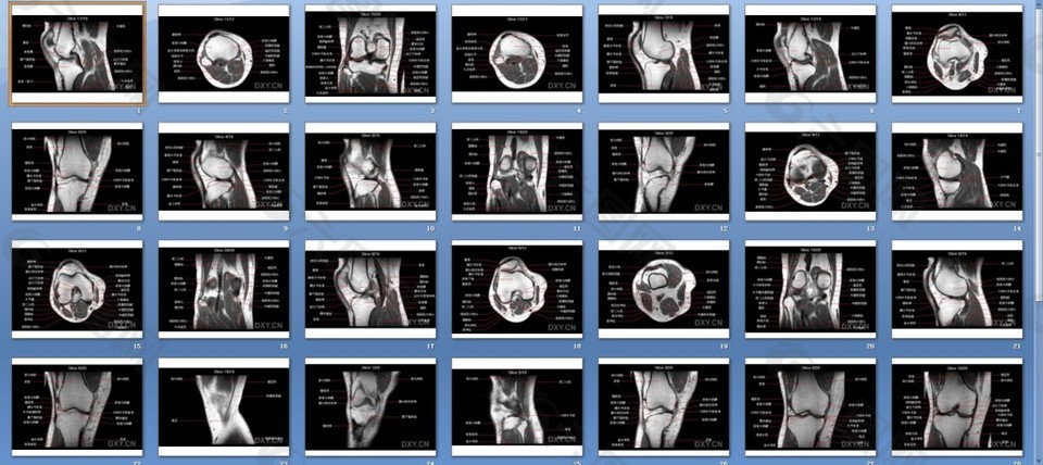 基础医学-人体解剖学-膝部MRI解剖课件