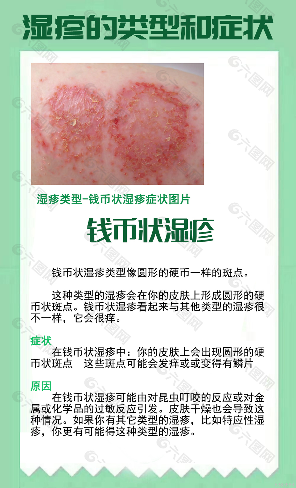 钱币状湿疹健康知识海报